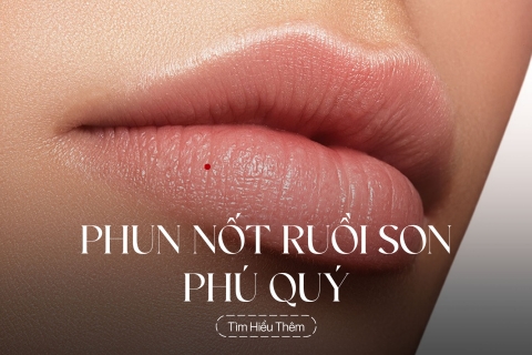 Phun nốt ruồi son phú quý